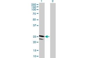 Western Blot analysis of TMED4 expression in transfected 293T cell line by TMED4 MaxPab polyclonal antibody. (TMED4 抗体  (AA 1-227))
