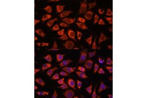 Immunofluorescence analysis of L929 cells using PI4KB antibody (ABIN7269287) at dilution of 1:100. (PI4KB 抗体  (AA 560-801))