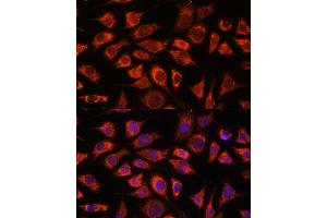 Immunofluorescence analysis of L929 cells using PI4KB antibody (ABIN7269287) at dilution of 1:100. (PI4KB 抗体  (AA 560-801))