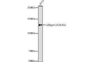 Western blot analysis of extracts of  cells, using Collagen I/COL1 antibody (ABIN6134502, ABIN6138839, ABIN6138840 and ABIN6221469) at 1:1000 dilution. (COL1A2 抗体  (AA 500-600))
