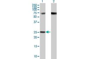 Western Blot analysis of RPP40 expression in transfected 293T cell line by RPP40 MaxPab polyclonal antibody. (RPP40 抗体  (AA 1-244))