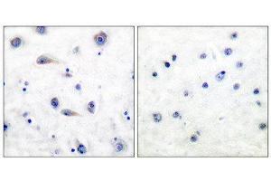 Immunohistochemistry (IHC) image for anti-Neurotrophic Tyrosine Kinase, Receptor, Type 2 (NTRK2) (pTyr515) antibody (ABIN1847226) (TRKB 抗体  (pTyr515))