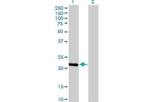 Western Blot analysis of BCL2L10 expression in transfected 293T cell line by BCL2L10 monoclonal antibody (M03), clone 1B11.