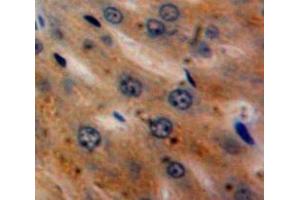 Used in DAB staining on fromalin fixed paraffin-embedded Liver tissue (alpha 2 Antiplasmin 抗体  (AA 340-491))