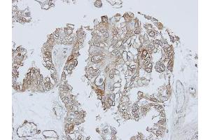 IHC-P Image Immunohistochemical analysis of paraffin-embedded OVCA xenograft, using TRHR, antibody at 1:100 dilution. (TRHR 抗体  (C-Term))