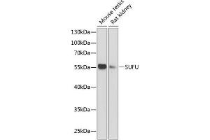 Western blot analysis of extracts of various cell lines, using SUFU antibody (ABIN6133029, ABIN6148692, ABIN6148694 and ABIN6217424) at 1:1000 dilution. (SUFUH 抗体  (AA 325-484))