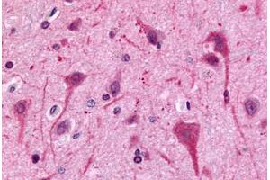 Anti-GPR75 antibody  ABIN1048866 IHC staining of human brain, neurons and glia.