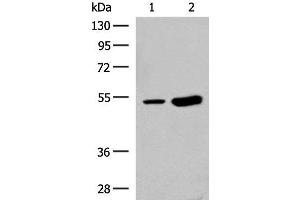 Western blot analysis of Human left thymus tissue and Mouse kidney tissue lysates using ZBTB43 Polyclonal Antibody at dilution of 1:250 (ZBTB43 抗体)