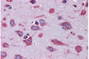 Human Brain, Cortex: Formalin-Fixed, Paraffin-Embedded (FFPE) (COX17 抗体  (AA 1-64))