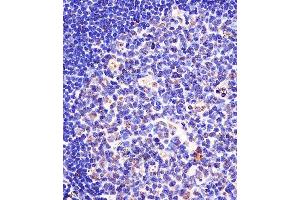 (ABIN657676 and ABIN2846668) staining SF3B1 in human tonsil tissue sections by Immunohistochemistry (IHC-P - paraformaldehyde-fixed, paraffin-embedded sections). (SF3B1 抗体  (N-Term))