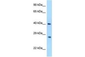 Image no. 1 for anti-Axin Interactor, Dorsalization Associated (AIDA) (AA 48-97) antibody (ABIN6748006) (AIDA 抗体  (AA 48-97))