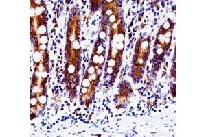 Immunohistochemistry (IHC) image for anti-Proto-oncogene tyrosine-protein kinase Src (Src) (AA 24-52) antibody (ABIN3029554)