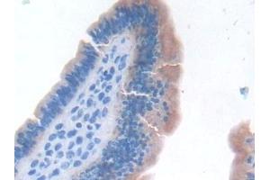 Detection of TNFa in Mouse Uterus Tissue using Monoclonal Antibody to Tumor Necrosis Factor Alpha (TNFa) (TNF alpha 抗体  (AA 80-235))