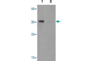 Western blot analysis of TSPY1 in A-20 cell lysate with TSPY1 polyclonal antibody  at 1 ug/mL in (1) the absence and (2) the presence of blocking peptide. (TSPY1 抗体  (C-Term))