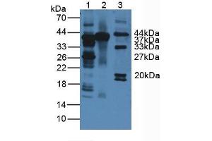 Western blot analysis of (1) Human Liver Tissue, (2) Mouse Liver Tissue and (3) Mouse Heart Tissue. (ARG 抗体  (AA 1-322))