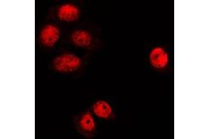 Immunofluorescent analysis of MGCRACGAP staining in K562 cells. (RACGAP1 抗体  (N-Term))