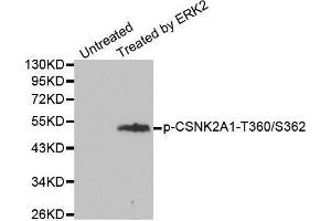 Western blot analysis of extracts from 293 cells, using Phospho-CSNK2A1-T360/S362 antibody. (CSNK2A1/CK II alpha 抗体  (pSer362, pThr360))