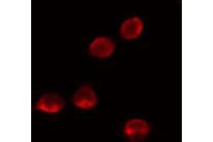 ABIN6274136 staining LOVO cells by IF/ICC.