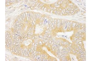Immunohistochemistry (IHC) image for anti-Growth Factor Receptor-Bound Protein 10 (GRB10) (AA 100-150) antibody (ABIN7448583) (GRB10 抗体  (AA 100-150))