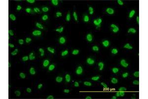 Immunofluorescence of monoclonal antibody to SNAI2 on HeLa cell. (SLUG 抗体  (AA 97-169))