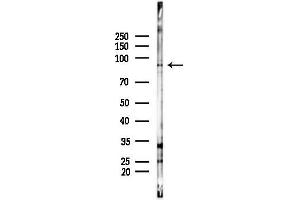 anti-FAST Kinase Domains 5 (FASTKD5) (Internal Region) antibody