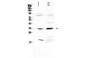 Western blot analysis of MyD88 using anti-MyD88 antibody . (MYD88 抗体  (AA 14-263))