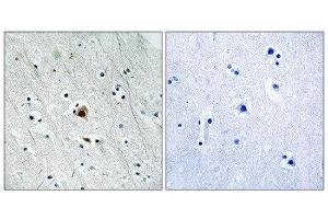 Immunohistochemistry (IHC) image for anti-Mitogen-Activated Protein Kinase-Activated Protein Kinase 2 (MAPKAPK2) (pSer272) antibody (ABIN1847788) (MAPKAP Kinase 2 抗体  (pSer272))