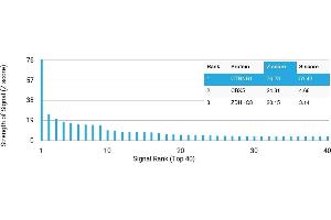 Protein Array (PAr) image for anti-Catenin (Cadherin-Associated Protein), beta 1, 88kDa (CTNNB1) antibody (ABIN7455968)