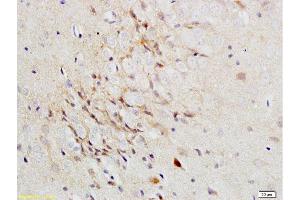 Immunohistochemistry (Paraffin-embedded Sections) (IHC (p)) image for anti-Versican (Vcan) (AA 3301-3396) antibody (ABIN741660)