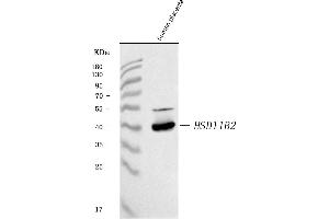 Western blot analysis of HSD11B2 using anti-HSD11B2 antibody (ABIN7602698).