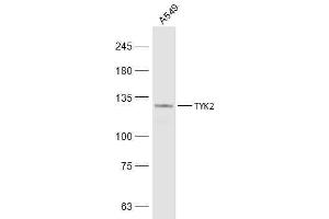 A549 lysates probed with TYK2 Polyclonal Antibody, Unconjugated  at 1:500 dilution and 4˚C overnight incubation. (TYK2 抗体  (AA 401-500))