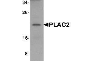Western Blotting (WB) image for anti-Tissue Differentiation-Inducing Non-Protein Coding RNA (TINCR) (Middle Region) antibody (ABIN1031042) (PLAC2 抗体  (Middle Region))