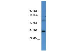 WB Suggested Anti-SPR Antibody Titration: 0. (SPR 抗体  (C-Term))
