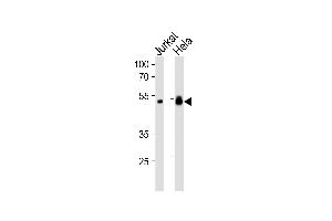 Western blot analysis of lysates from Jurkat,Hela cell line (from left to right),using K Antibody (ABIN484227 and ABIN1533608).