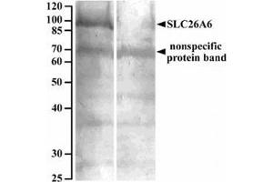 AP32082PU-N SLC26A6 Antibody staining of Human renal cortical brush-border membrane lysate at 10 µg/ml (90 µg protein denatured at 37°C for 30min) with (B) and without (A) blocking with the immunizing peptide. (SLC26A6 抗体  (Internal Region))