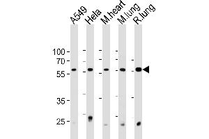 PRS4 Antibody (C-term) (ABIN1881692 and ABIN2843376) western blot analysis in A549,Hela cell line and mouse heart and lung,rat lung tissue lysates (35 μg/lane). (PSMC1 抗体  (C-Term))