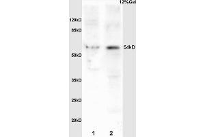 L1 mouse brain lysates L2 mouse embryo lysates probed with Anti Phospho-MEF2A (Ser408) Polyclonal Antibody, Unconjugated (ABIN743783) at 1:200 overnight at 4 °C. (MEF2A 抗体  (pSer408))