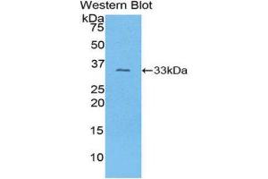 Western Blotting (WB) image for anti-Collagen, Type I, alpha 1 (COL1A1) (AA 1225-1453) antibody (ABIN1077674) (COL1A1 抗体  (AA 1225-1453))