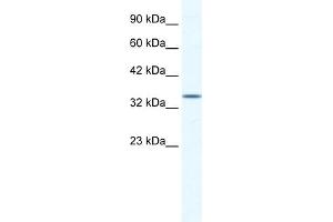 WB Suggested Anti-ZFP589 Antibody Titration:  1. (ZFP589 (Middle Region) 抗体)