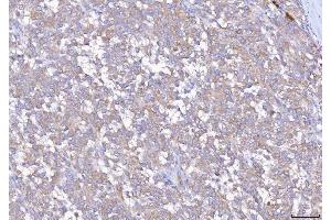 IHC analysis of EIF5A using anti-EIF5A antibody (ABIN7602568). (EIF5A 抗体  (AA 86-154))