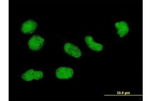 Immunofluorescence of monoclonal antibody to H3F3B on HeLa cell. (H3F3B 抗体  (AA 1-136))