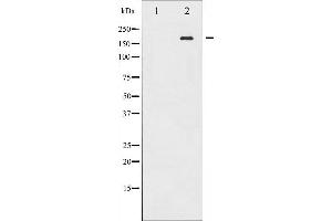Western blot analysis of EGFR phosphorylation expression in EGF treated A431 whole cell lysates,The lane on the left is treated with the antigen-specific peptide. (EGFR 抗体  (pTyr869))