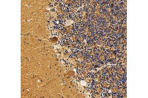 IHC analysis of DNM3 using anti-DNM3 antibody (ABIN7601163).