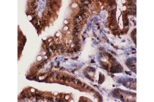 IHC-P: Caspase-3 antibody testing of mouse intestine tissue (Caspase 3 抗体  (AA 67-175))