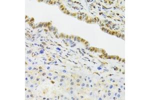 Immunohistochemistry (Paraffin-embedded Sections) (IHC (p)) image for anti-Elongation Factor Tu GTP Binding Domain Containing 2 (EFTUD2) (AA 1-205) antibody (ABIN6139968)