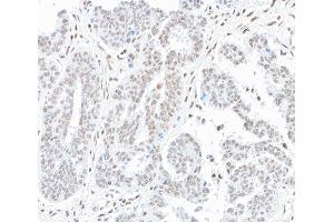 Immunohistochemistry (IHC) image for anti-hSET1 (AA 1200-1250) antibody (ABIN7454027)