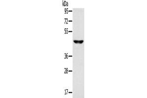 Western Blotting (WB) image for anti-Monocarboxylate Transporter 3 (MCT3) antibody (ABIN2433812) (MCT3 抗体)