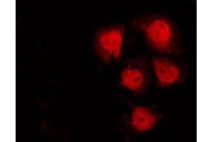 ABIN6272615 staining A549 by IF/ICC. (CDK17 抗体  (Internal Region))