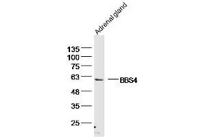Mouse adrenal gland lysates probed with BBS4 Polyclonal Antibody, unconjugated  at 1:300 overnight at 4°C followed by a conjugated secondary antibody for 60 minutes at 37°C. (BBS4 抗体  (AA 431-519))