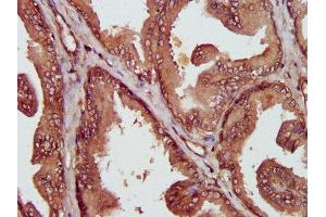 Immunohistochemistry (IHC) image for anti-Macrophage Migration Inhibitory Factor (Glycosylation-Inhibiting Factor) (MIF) (AA 2-115) antibody (ABIN7158882)